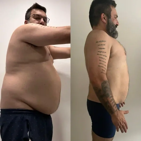 Antes e depois — aluno Team Diou